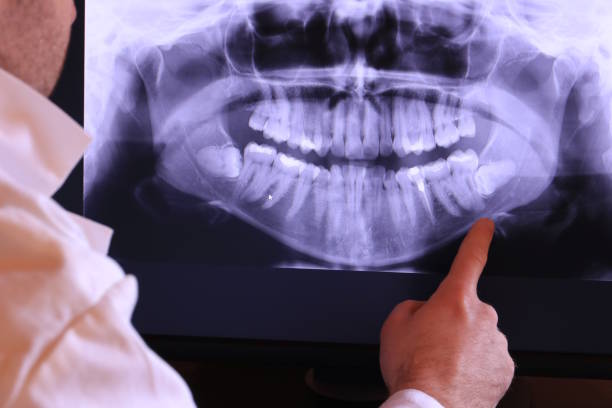 Best Emergency Denture Repair in Anchorage, AK