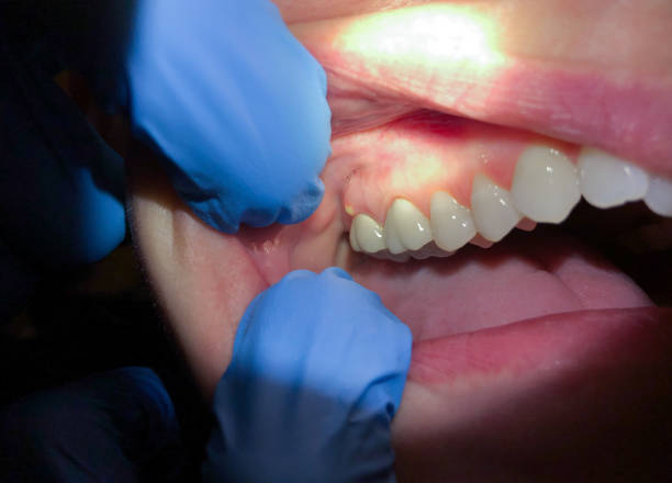 Best After-Hours Dental Trauma Care in Anchorage, AK